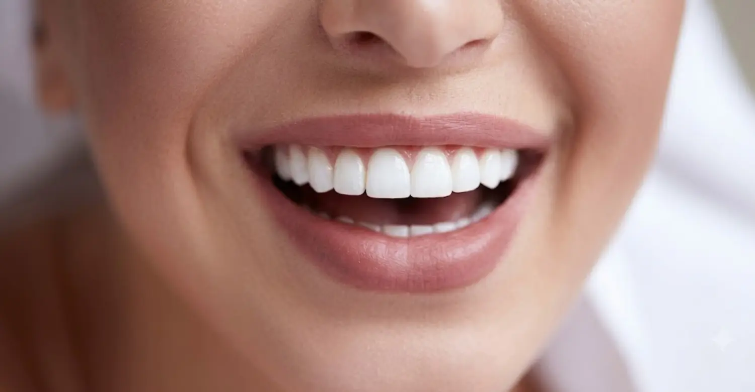 straighten teeth fast 2